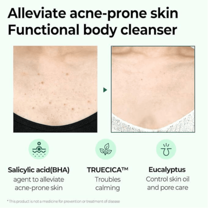 منظف الجسم لتنقية البشرة من Some By Mi - AHA-BHA-PHA Miracle Acne Clear لمدة 30 يومًا بسعة 400 غرام