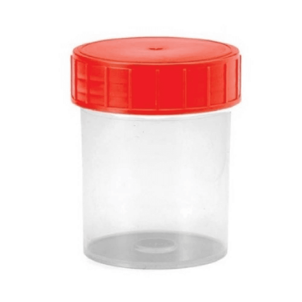 Sterile Urine Specimen Container 30ml