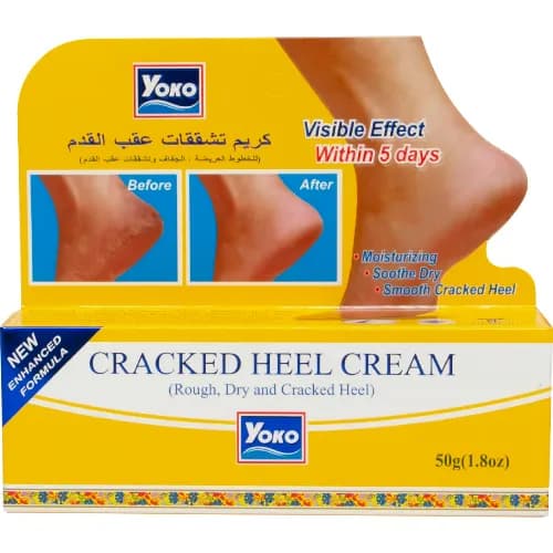 Yoko Cracked Heel Cream 50 Gm