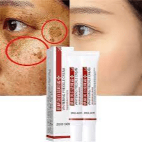 Freckles Whitening Dark Sopt Cream 50 Ml