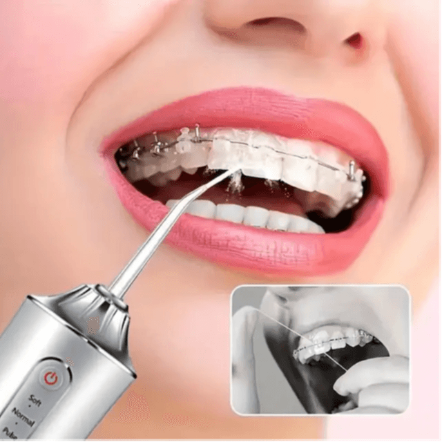 Water Flosser, Electric Teeth Cleaning Device, With 4 Nozzles - Portable Oral Floss Cleaner For Men And Women Pink