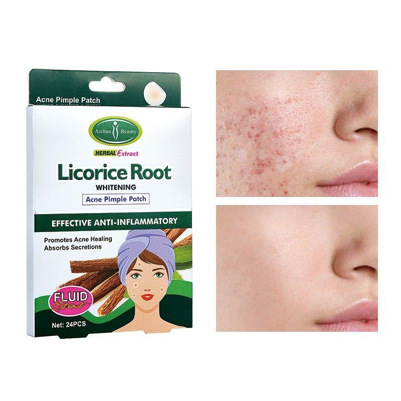 Aichun Beauty Licorice Root Acne Pimple Patch 24 S