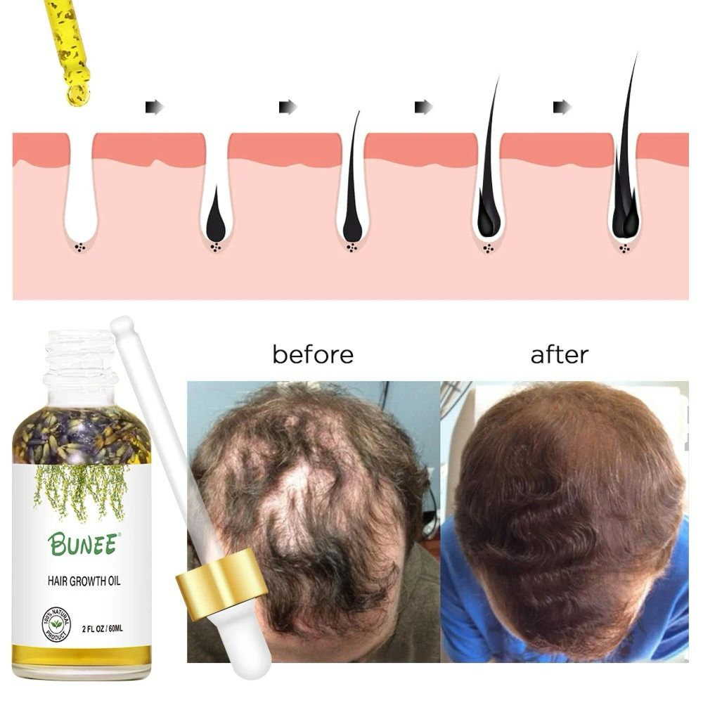 Hair Growth oil