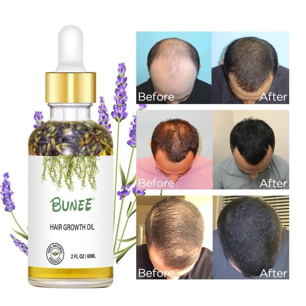 Hair Growth oil